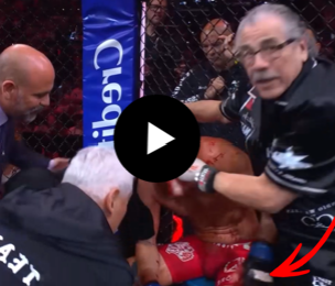 Nate Diaz bleeding heavily in corner before fight stoppage against Mike Perry